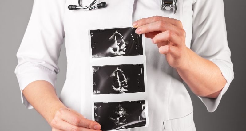 ISEIE-Máster en Arritmias Cardíacas