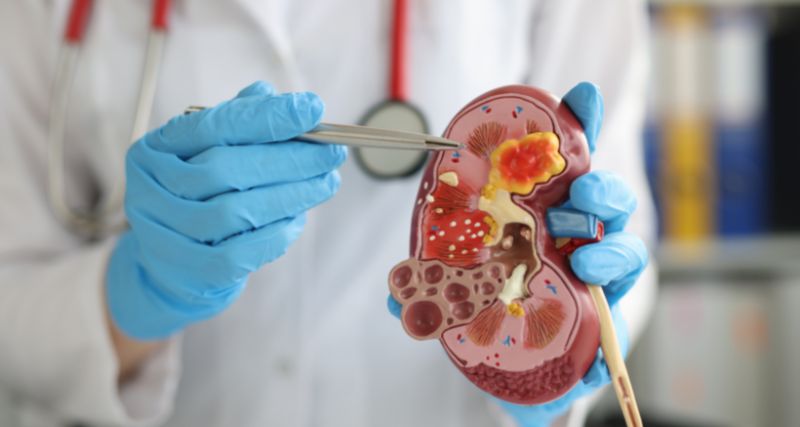 Maestría Cirugía Urológica