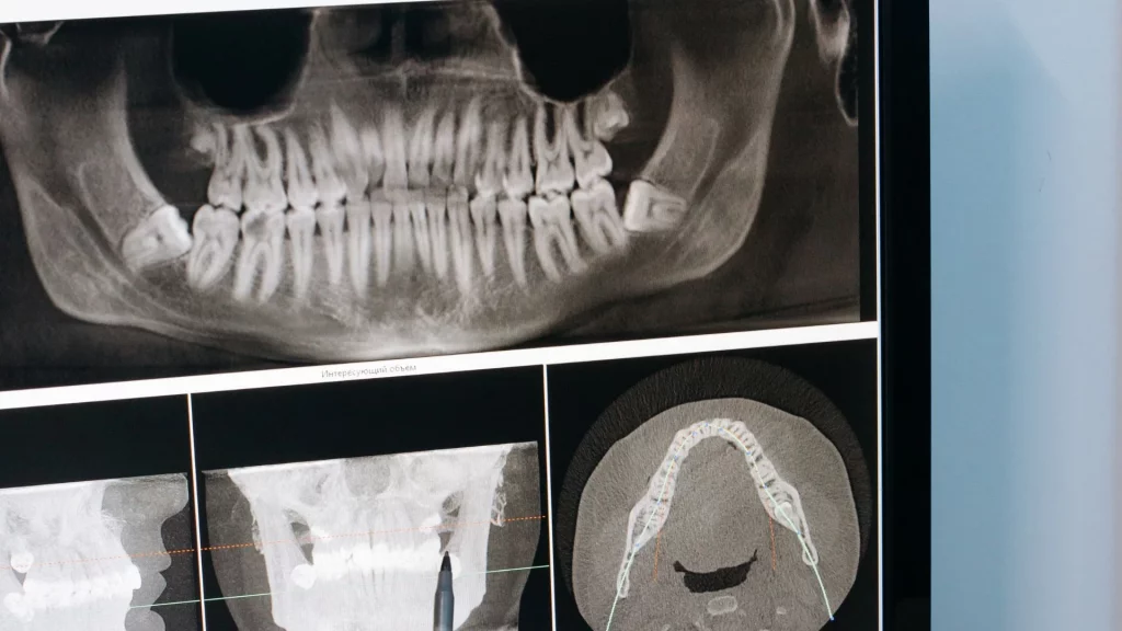 ISEIE, odontologia digital, odontología digital, curso odontologia digital, curso de odontologia digital, cursos odontologia digital, odontología digital cursos, odontologia, odontología, que es odontologia, odontología que es, odontología que es, odontologia carrera, odontologia carrera, odontologia carrera, facultad de odontologia, Máster Odontología Digital