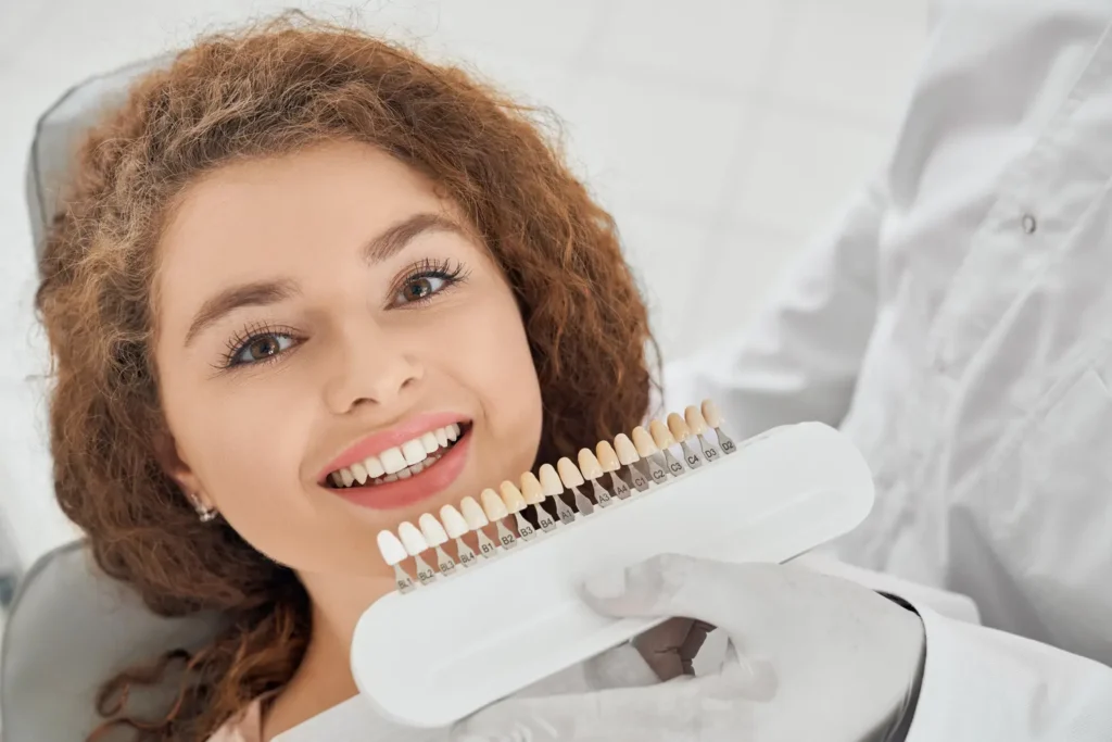 Curso estética dental 2