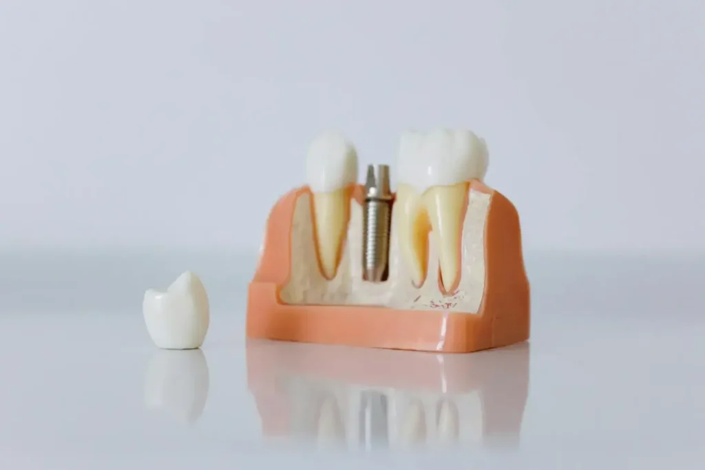 Maestría-en-Odontologia-Regenerativa-3