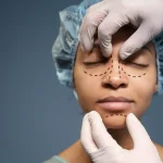 Maestría en Cirugía Estética Facial Rinoplastia Blefaroplastia y Rejuvenecimiento 1