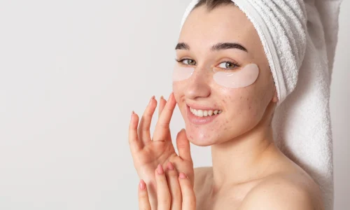 curso-tratamiento-del-acne.webp